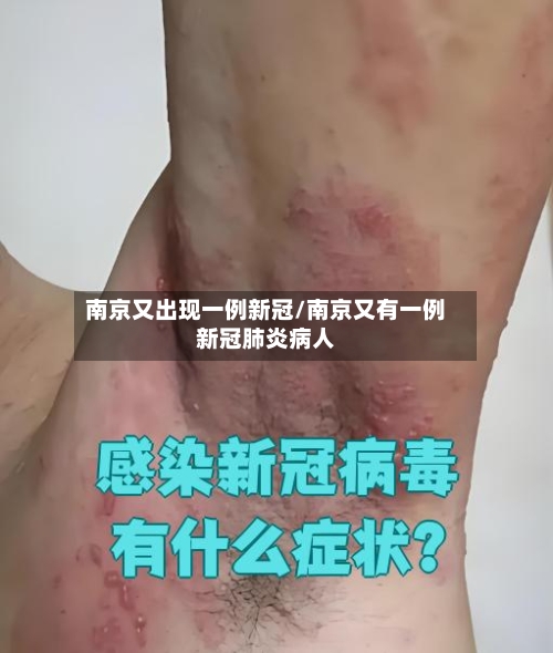南京又出现一例新冠/南京又有一例新冠肺炎病人