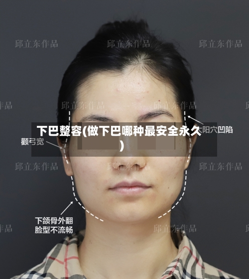 下巴整容(做下巴哪种最安全永久)-第2张图片