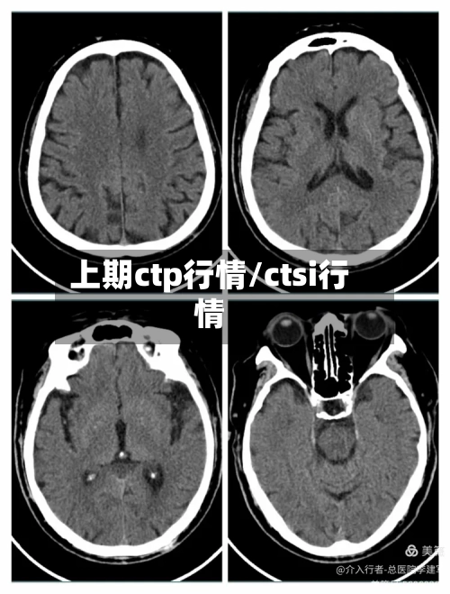 上期ctp行情/ctsi行情